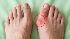 Digamos "adeus" aos ossos dos pés: 6 exercícios para relaxar os pés